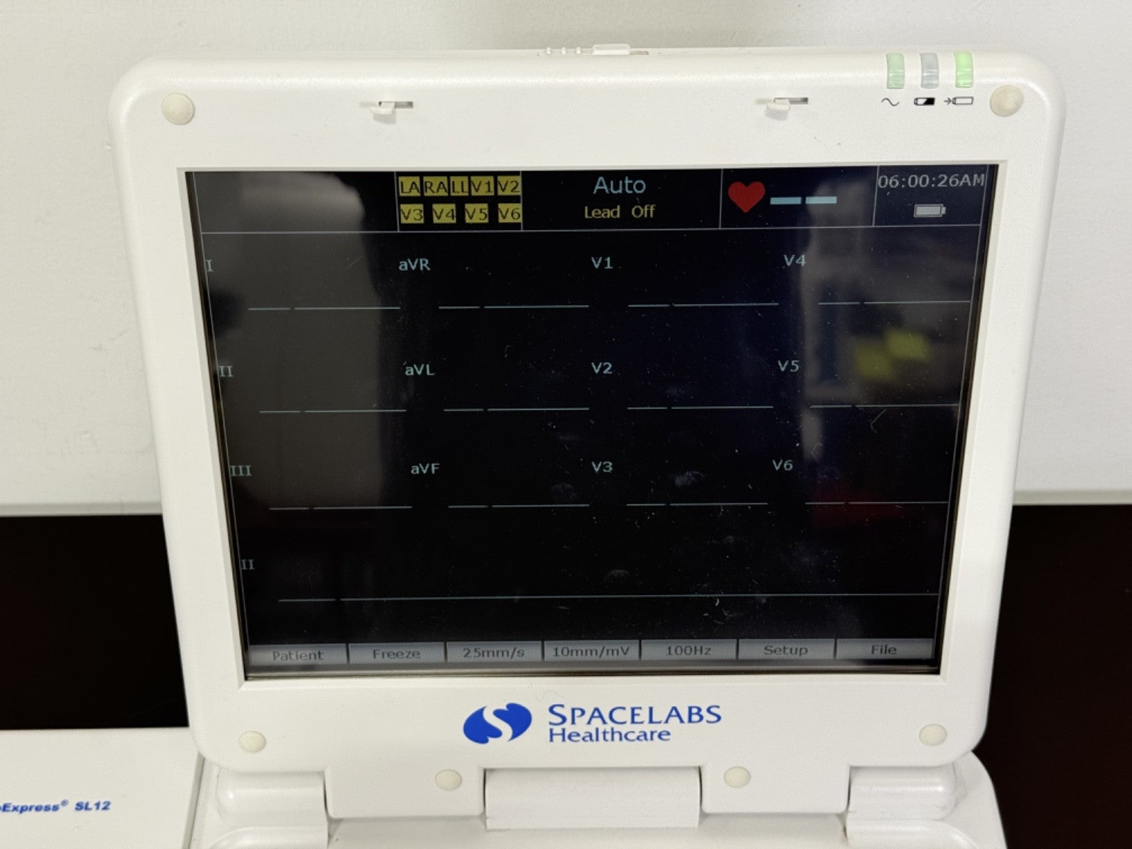 Spacelabs CardioExpress SL12 ECG EKG Machine w/ Display & Printer2